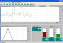 heart rate variability
